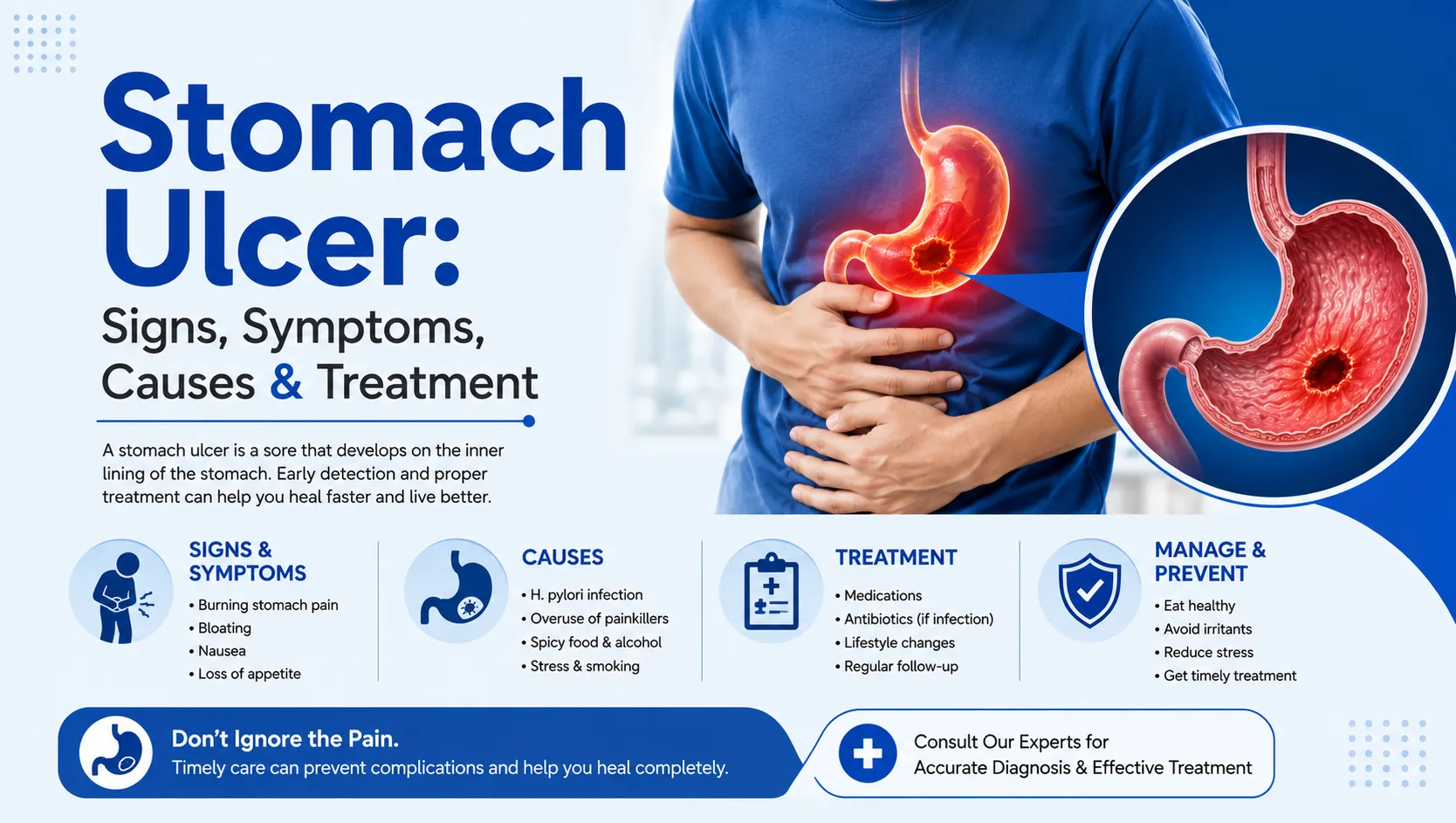 Stomach Ulcer: Signs, Symptoms, Causes & Treatment